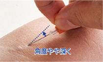 画像：針の角度を最初のときよりもやや深く